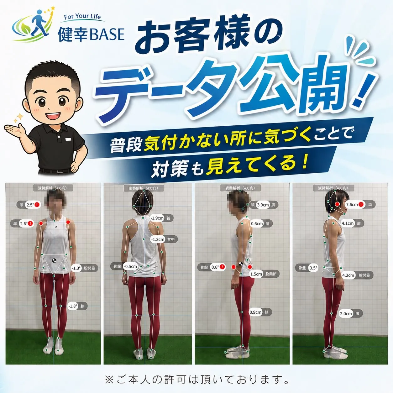 お客様に許可を頂き実際の姿勢画像を公開！