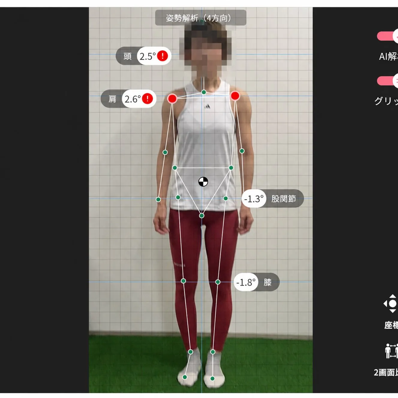 お客様に許可を頂き実際の姿勢画像を公開！