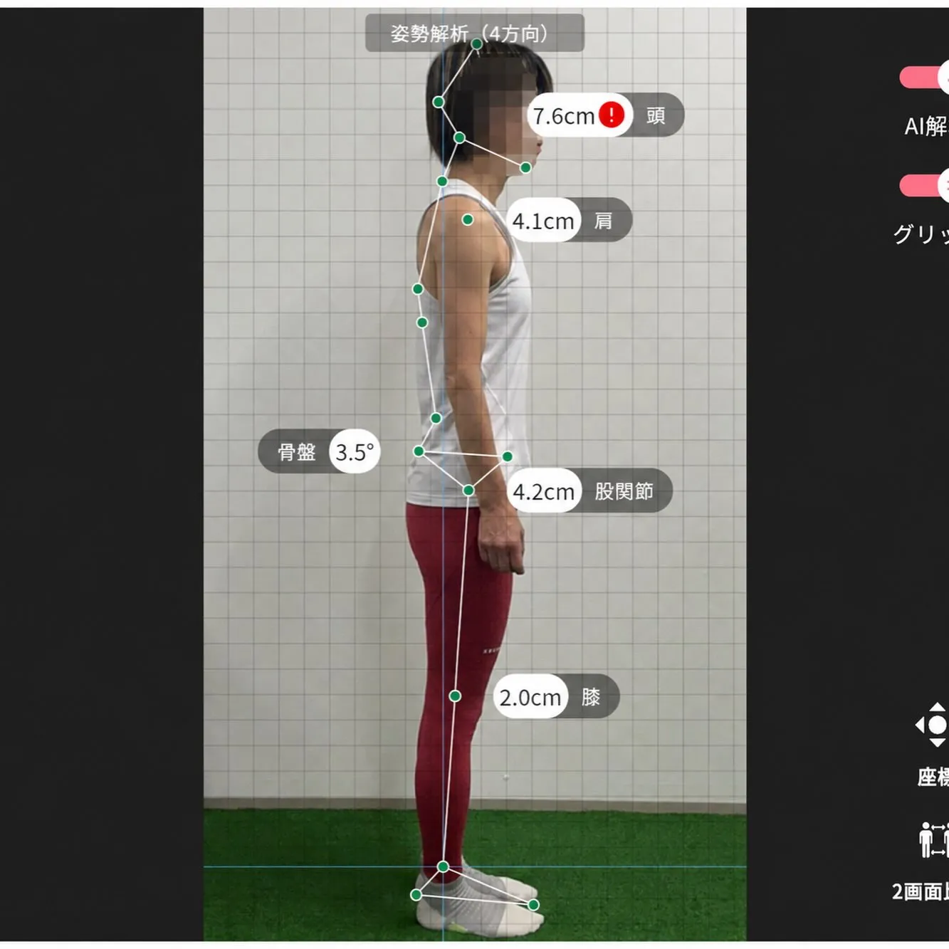 お客様に許可を頂き実際の姿勢画像を公開！