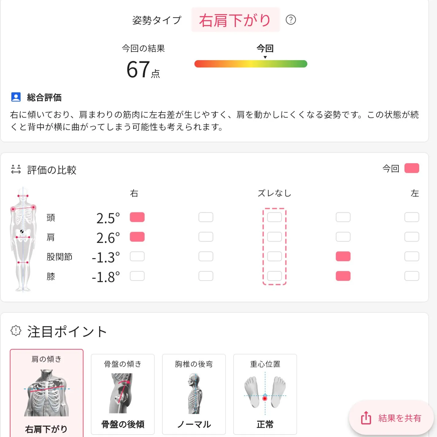 お客様に許可を頂き実際の姿勢画像を公開！